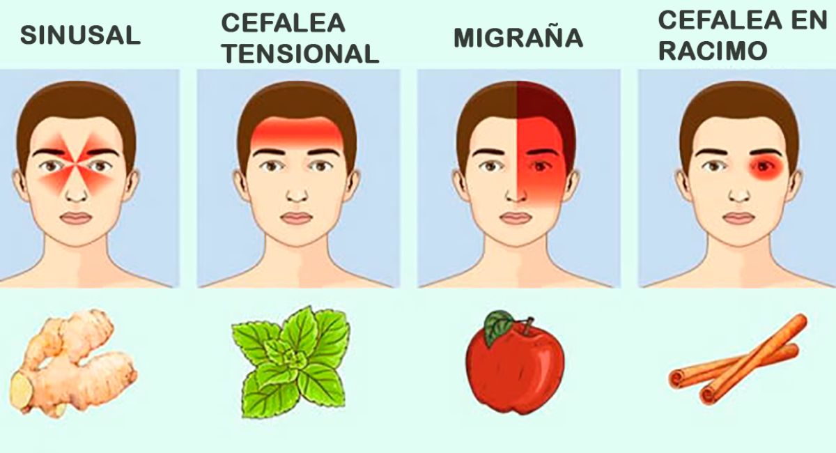 Tipos de dolores de cabeza y su respectivo remedio natural para aliviarlos