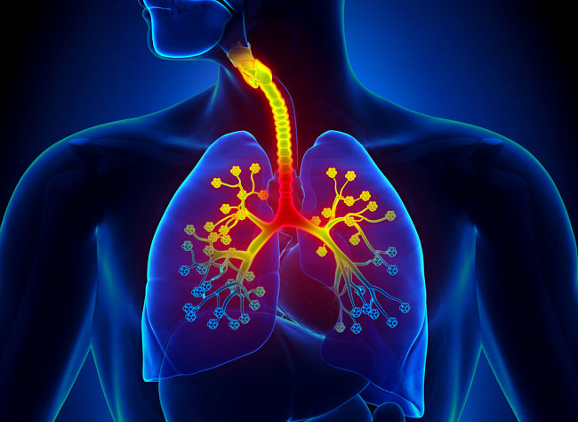 Bronquitis aguda: signos, causas, complicaciones y tratamiento