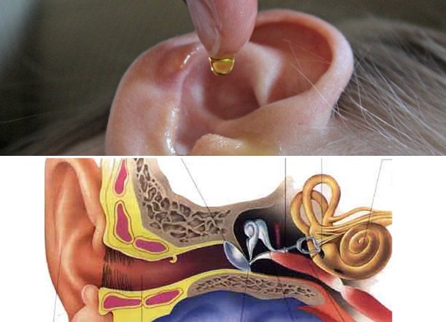 8 remedios caseros para eliminar el exceso de cera del oído