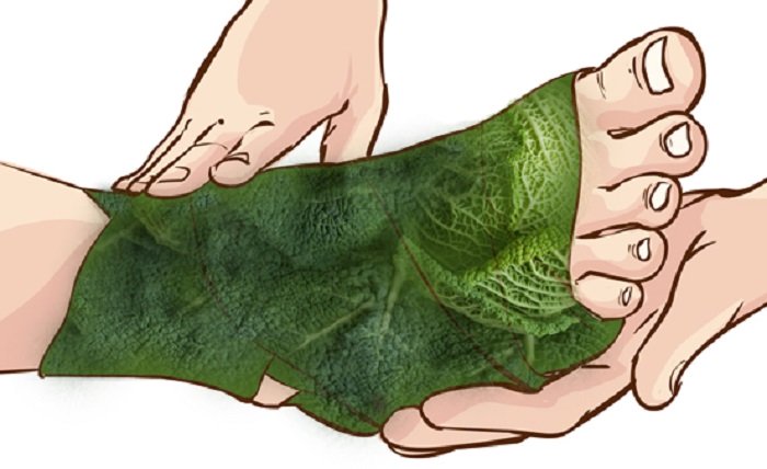 Vendaje con hojas de repollo para aliviar el dolor en las articulaciones