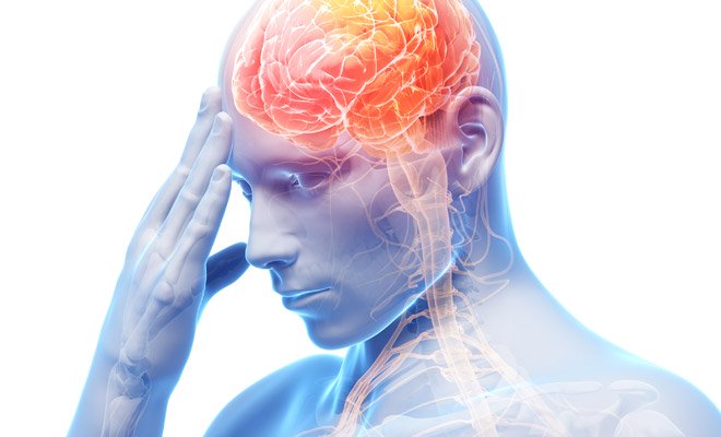 Epilepsia: Causas, síntomas y cómo diagnosticarla