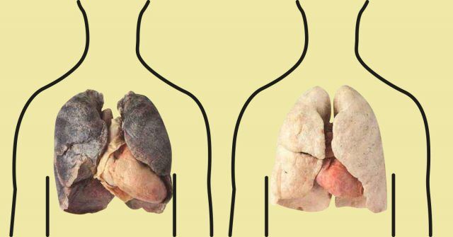 4 Alimentos que purifican los pulmones