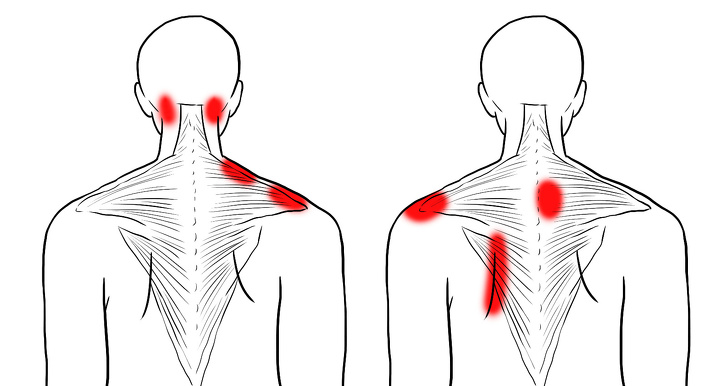 11 Estiramientos para aliviar la tensión en el cuello y los hombros