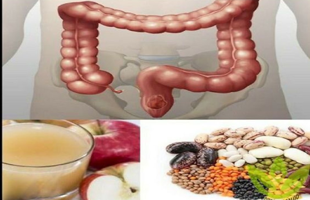 ﻿Diez alimentos naturales que te ayudarán a limpiar el colon