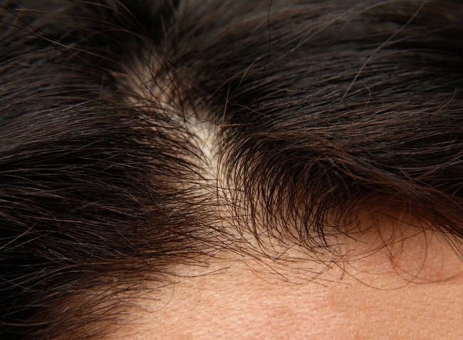 Cómo fortalecer el cuero cabelludo de forma natural
