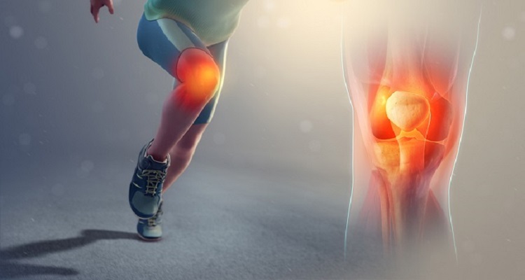 ¿Sientes dolor en tus rodillas al correr? Fortalecelas y evita molestias con estos ejercicios