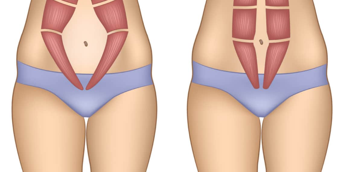 5 cosas que debes hacer para perder grasa del vientre