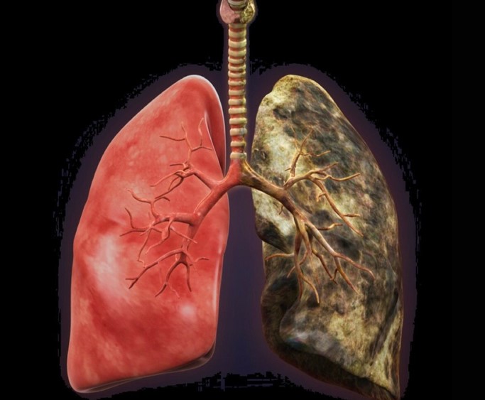 Cómo desintoxicar de forma natural sus pulmones