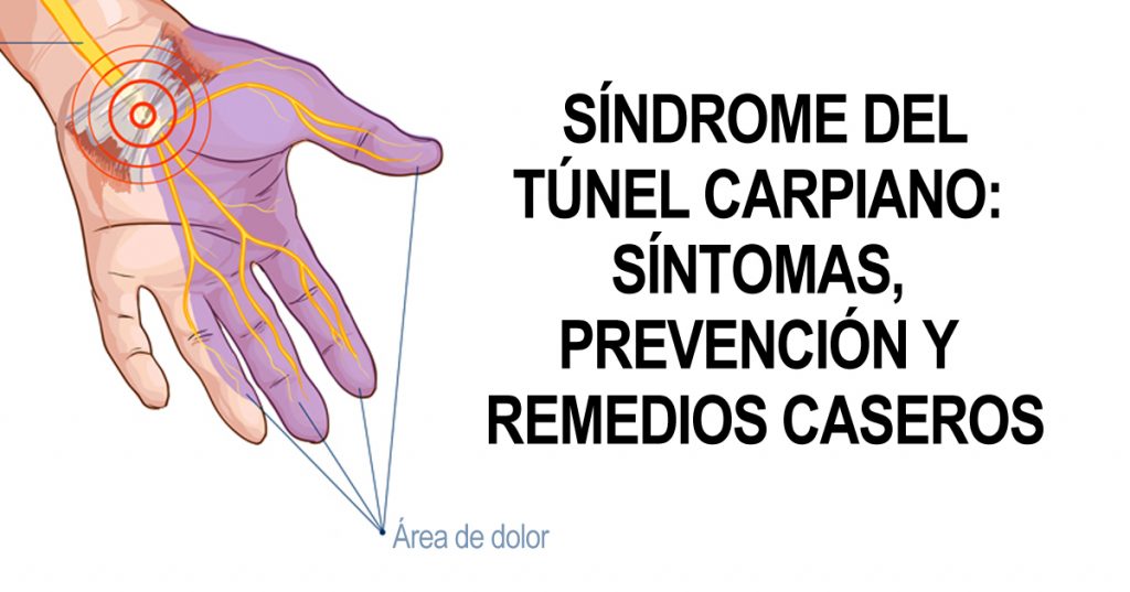 Síndrome del túnel carpiano: Síntomas, prevención y remedios caseros