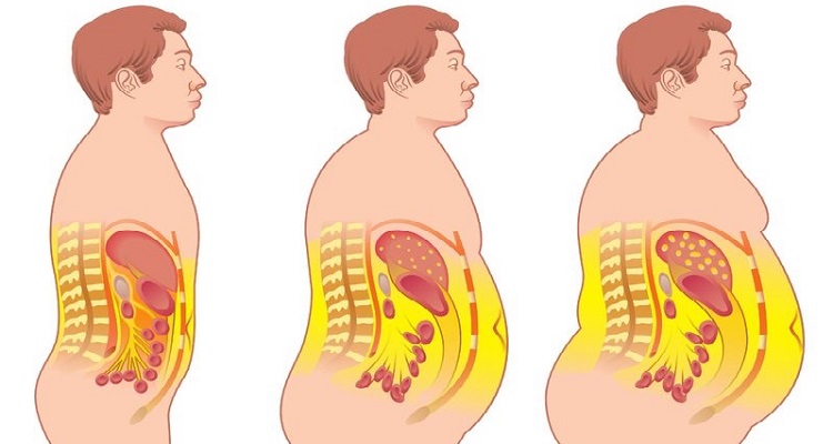 ¡El peligro detrás de la grasa abdominal! Aquí 4 alimentos para ayudarte a perderla